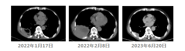 【业务介绍】肿瘤医学部：免疫治疗——晚期癌症患者的新希望