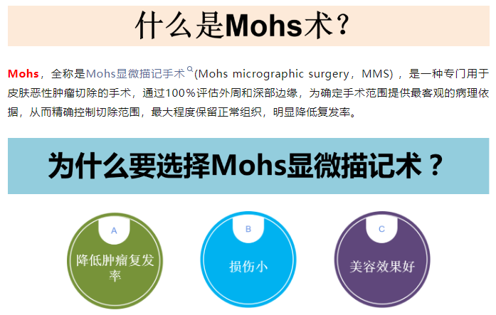 【科室介绍】烧伤整形医疗美容皮肤科：开展mohs手术，精准治疗皮肤癌
