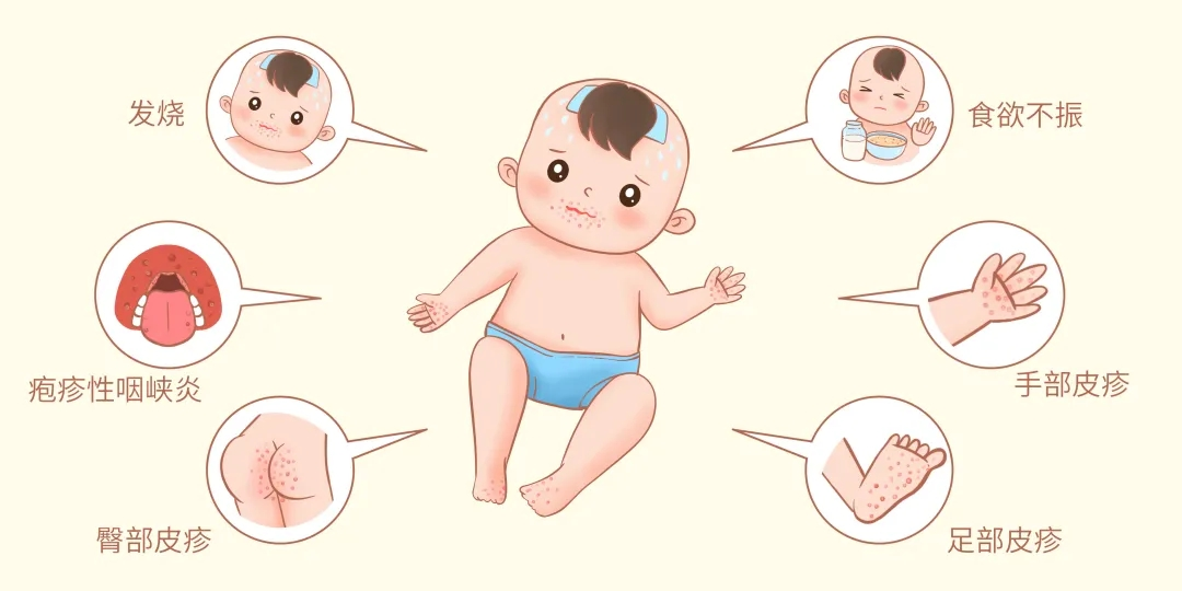 【健康科普】秋冬季手足口病风险提示，家长请查收！